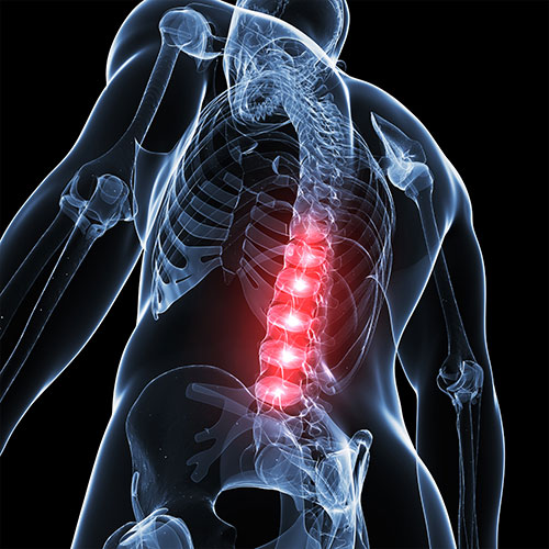 medical illustration of spine x ray